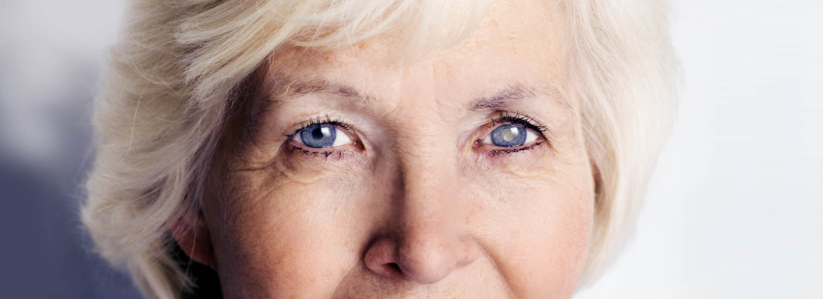 Cataract Surgery in Kirksville